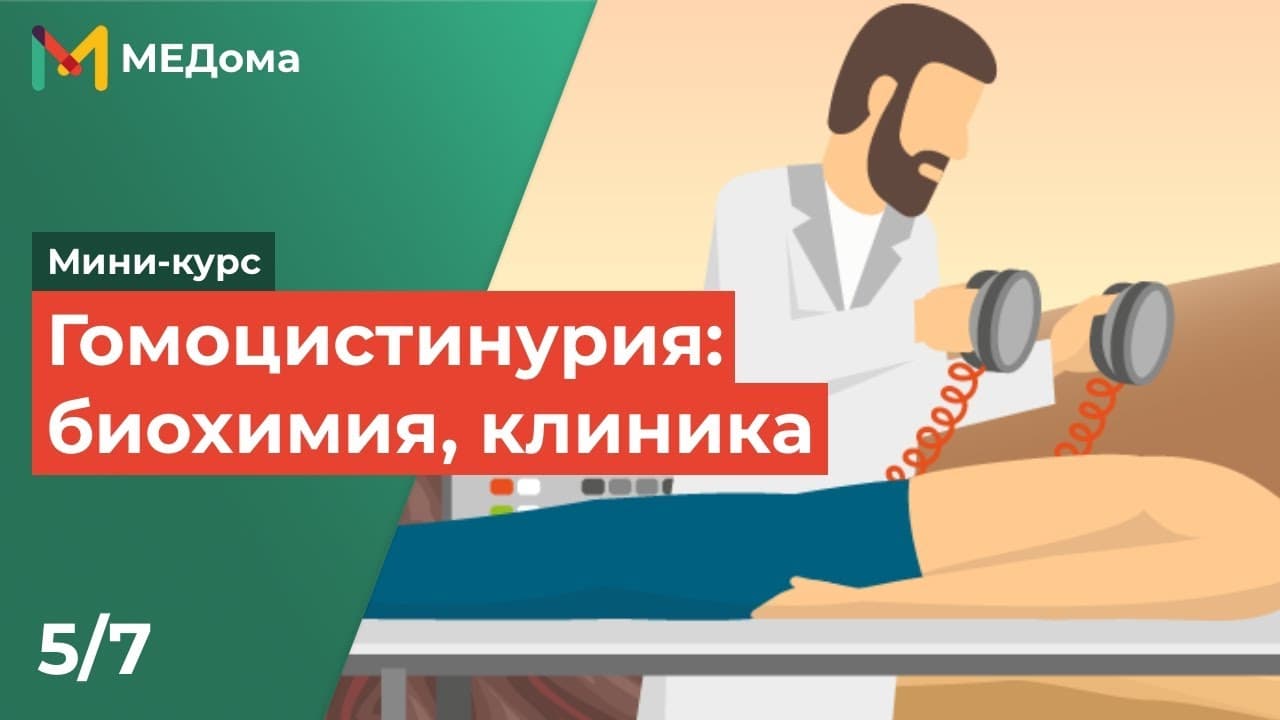 Гомоцистинурия